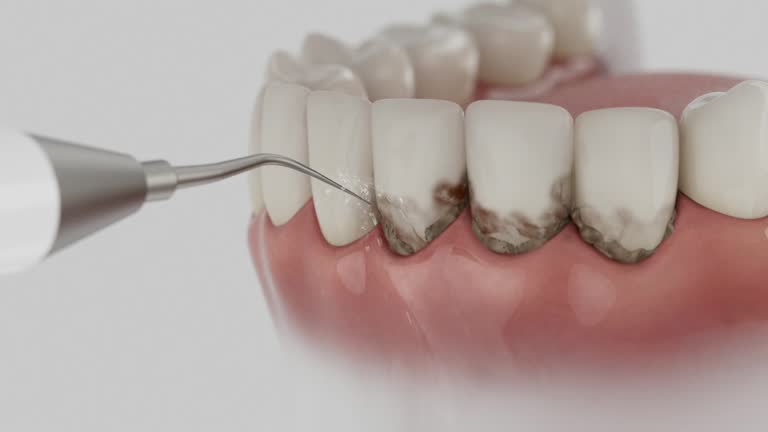 Trusted Invisalign Clear Aligners service in Simpson, PA - Dentist Open Now